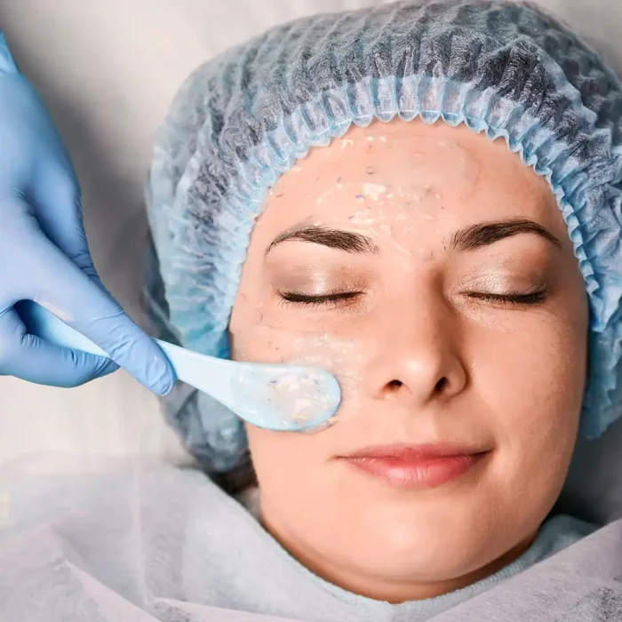 fabi-maciel-estetica-peeling-vegano
