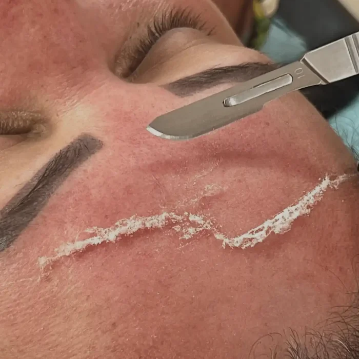 fabi-maciel-estetica-procedimento-dermaplaning-sensory-8