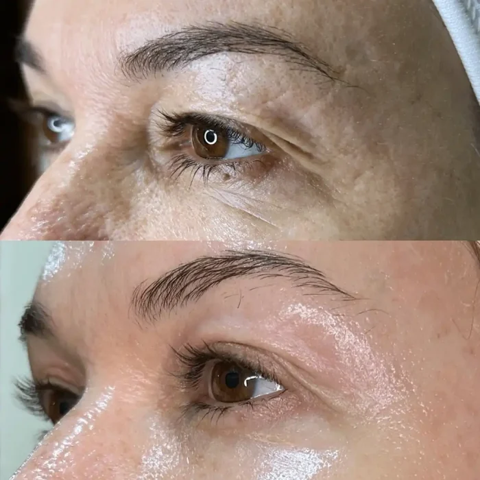 fabi-maciel-estetica-procedimento-peeling-sal-marinho-galeria-6