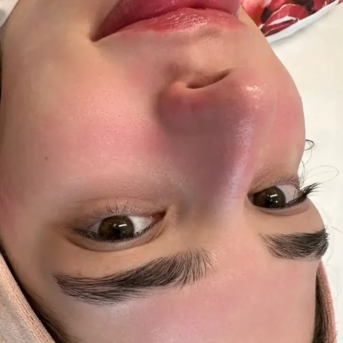 fabi-maciel-estetica-procedimento-peeling-vegano-10