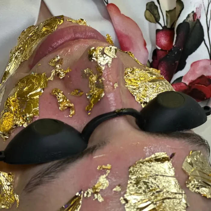 fabi-maciel-estetica-procedimento-peeling-vegano-6