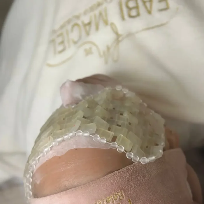 fabi-maciel-estetica-procedimento-peeling-vegano-7